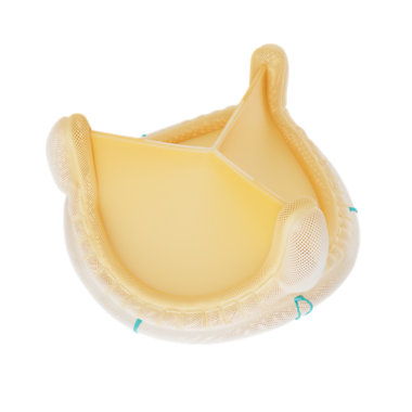 Avalus Ultra Bioprothesis
